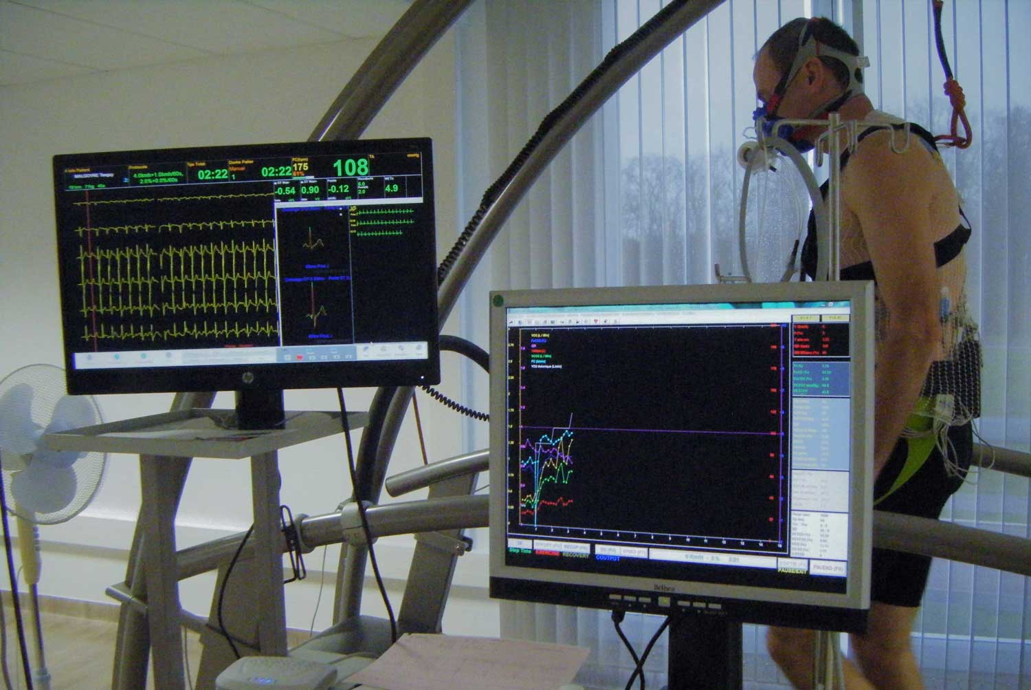 Stress test on bicycle with VO2 and ECG screens