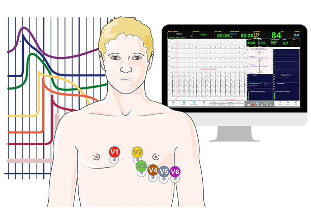 Electrocardiogramme